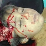 EXTREMELY GRAPHIC: Husam Jamal Faraj, who was killed in an alleged Russian airstrike on Khan Sheikhoun, November 15th (via VDC)