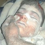 Unnamed boy killed in alleged Russian strike at Myassar, November 15th