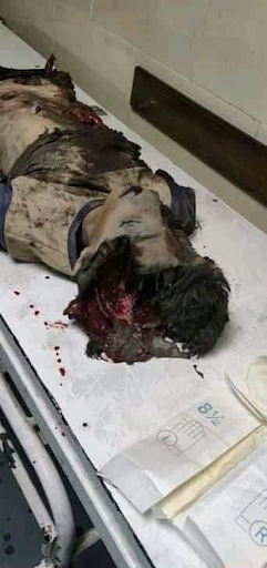 Very graphic images of the children killed in Israeli strikes on Al Shati camp on May 15th, 2021. (Image posted by Sharef Suliman Al Farhta via Facebook)