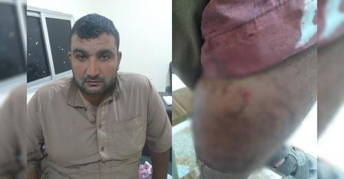 Qaban Aziz Al-Khalil (29 years old), injured by alleged Turkish drone strikes on the village of Safawiyah on September 21, 2023. (Image posted by Hawar News)