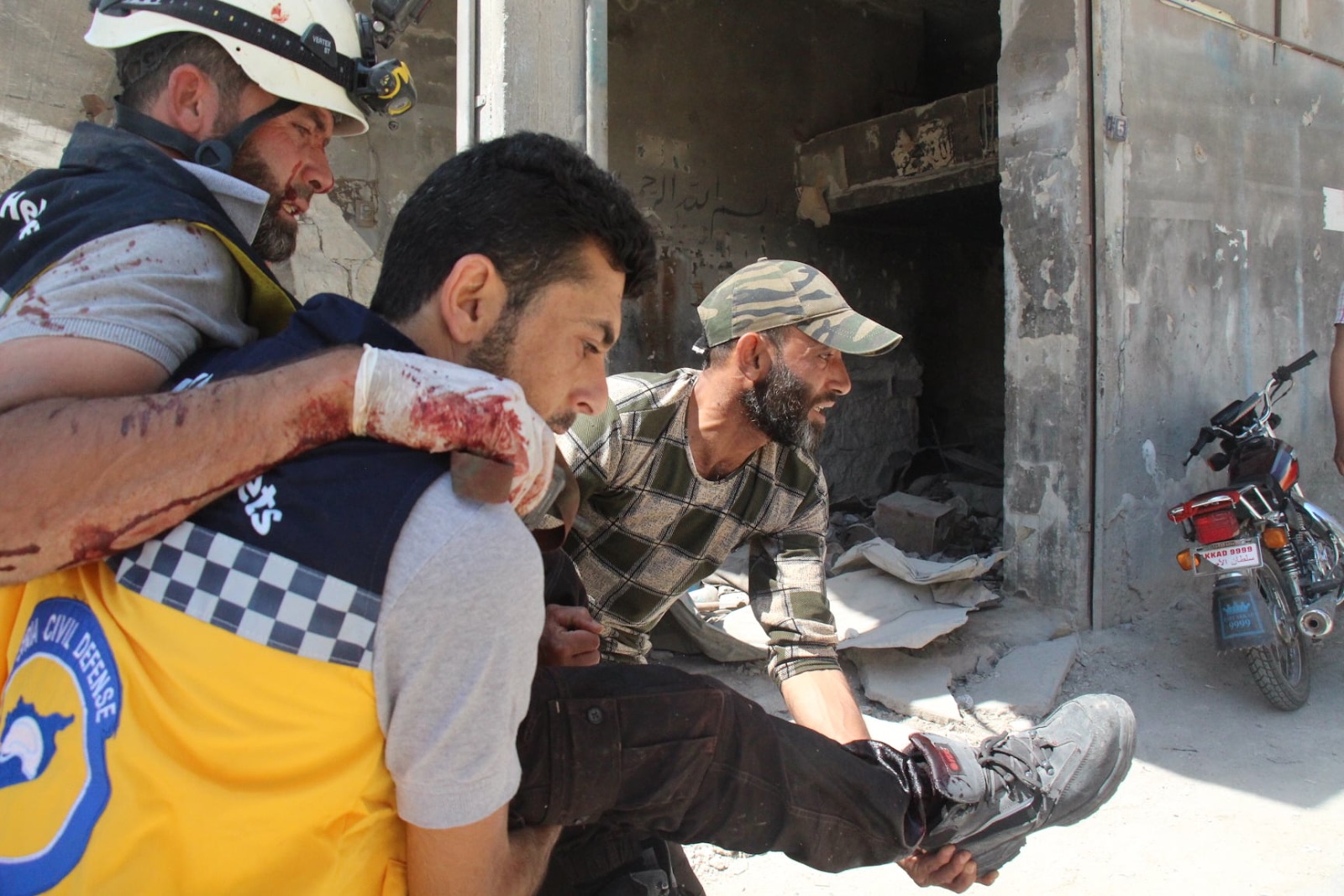 Injured Civil Defense member following a double strike on Sarja on July 17, 2021. (Image posted by Syrian Civil Defense)