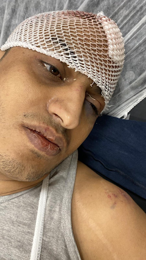 Abu Yasser al-Yemeni, allegedly one of the leaders of the "Islamic State" organization who was injured by Coalition strikes in al-Bab on December 20, 2022. (Image posted by @almohrarmedia2)