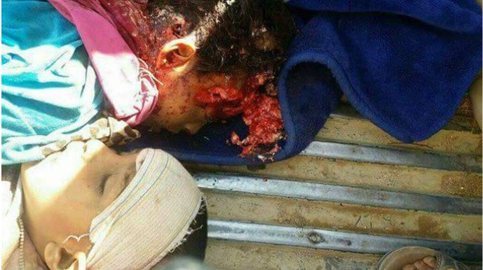 An alleged child casualty of the January 29th 2017 raid (@amerAlhamiqaniu, January 29th 2017)