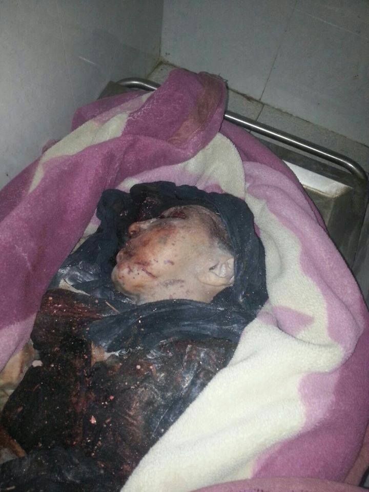 A deceased victim of an alleged coalition airstrike in Iraq, April 29 2015 (via Iraqi Revolution)