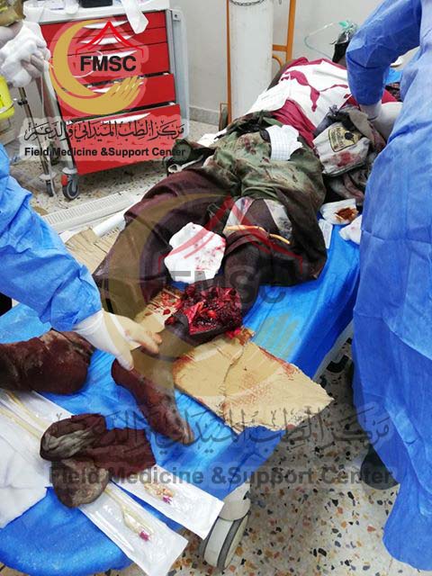 Alleged victim of LNA shelling on Tajoura on April 9th, 2020 (via FMSC)