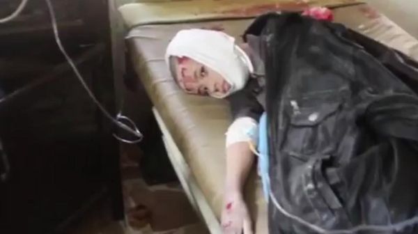 An injured child allegedly hit by Coalition airstrikes on Al Qa'im on January 29th.