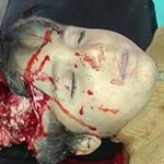 EXTREMELY GRAPHIC: Husam Jamal Faraj, who was killed in an alleged Russian airstrike on Khan Sheikhoun, November 15th (via VDC)