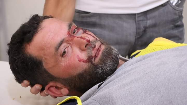 Injured Civil Defense member following a double strike on Sarja on July 17, 2021. (Image posted by @anasanas84)