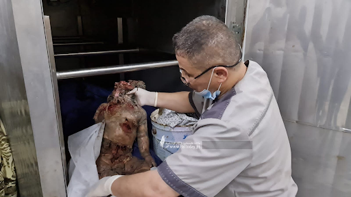 Very graphic image of a child allegedly killed in strikes on Al Jeniya neighborhood on May 13, 2021. (Image posted by Paltoday News)