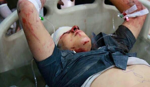 Photos of the alleged incident provided by an eyewitness, resident in Mosul that Airwars made contact with by phone on 20/04/2015. They were taken by his brother who lives in the neighbourhood that was bombed