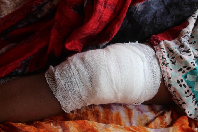 Chilld allegedly injured by US strike on Kunya Barrow on May 17th, 2020 (via Somali Memo)