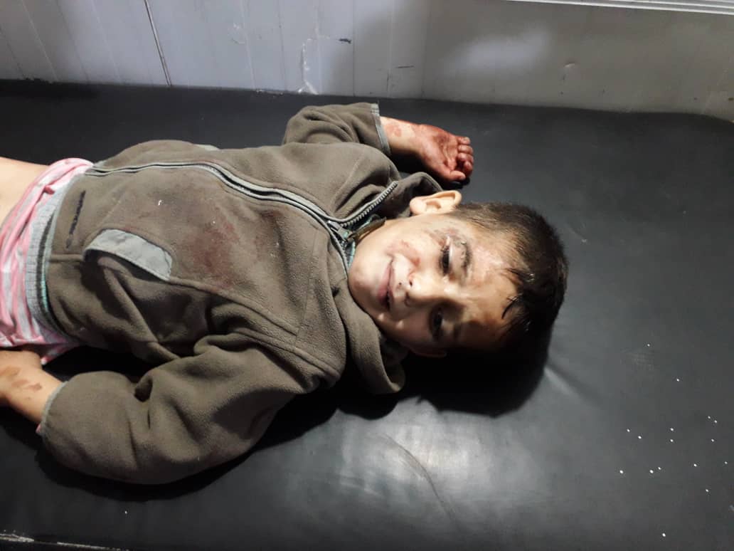 A child injured in an alleged Turkish attack on Tal Rifaat on Dec 2nd, 2019 (via ANHA).