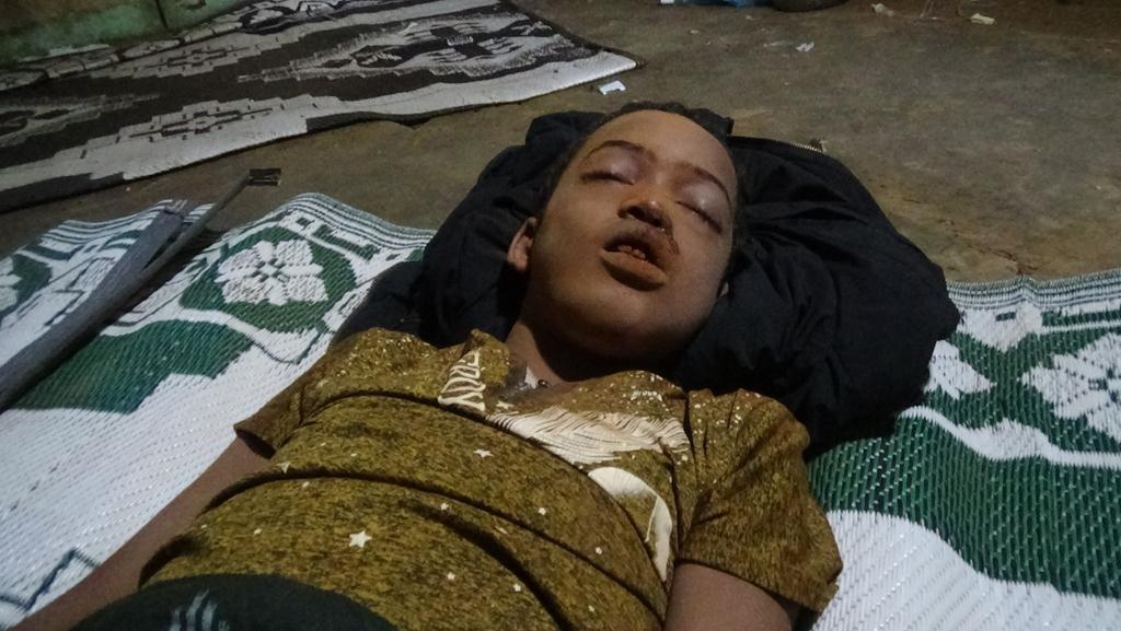 Picture of alleged victim of US airstrike on Jilib on July 29h, 2020 (via Somali Memo)