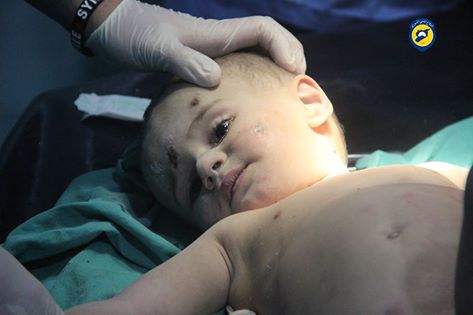 Baby Ahmad Al Rajab recovered from under the rubble after intense warplanes shelling on Al Sukkari neighborhood, Aleppo (via SN4HR)