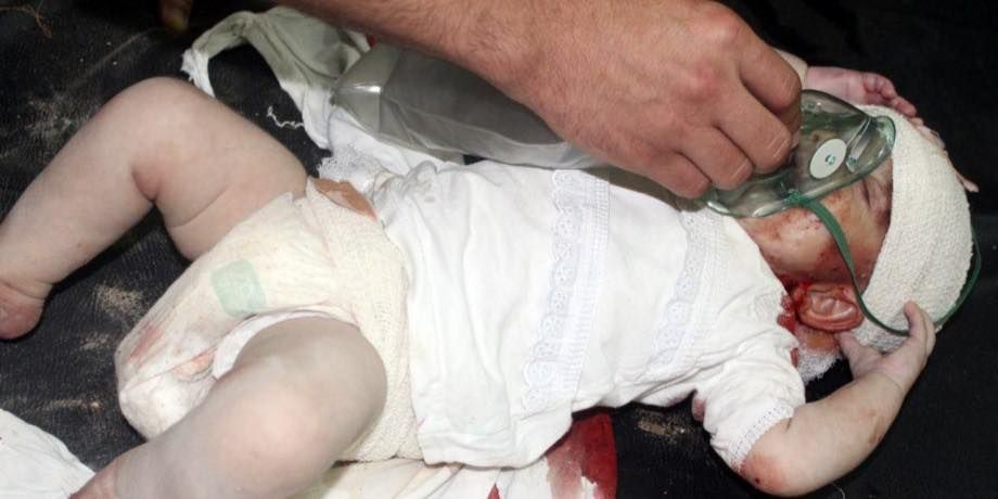 An infant injured in an alleged Coalition strike at Ar Rutbah, August 6 2015 (via Iraqi Revolution)