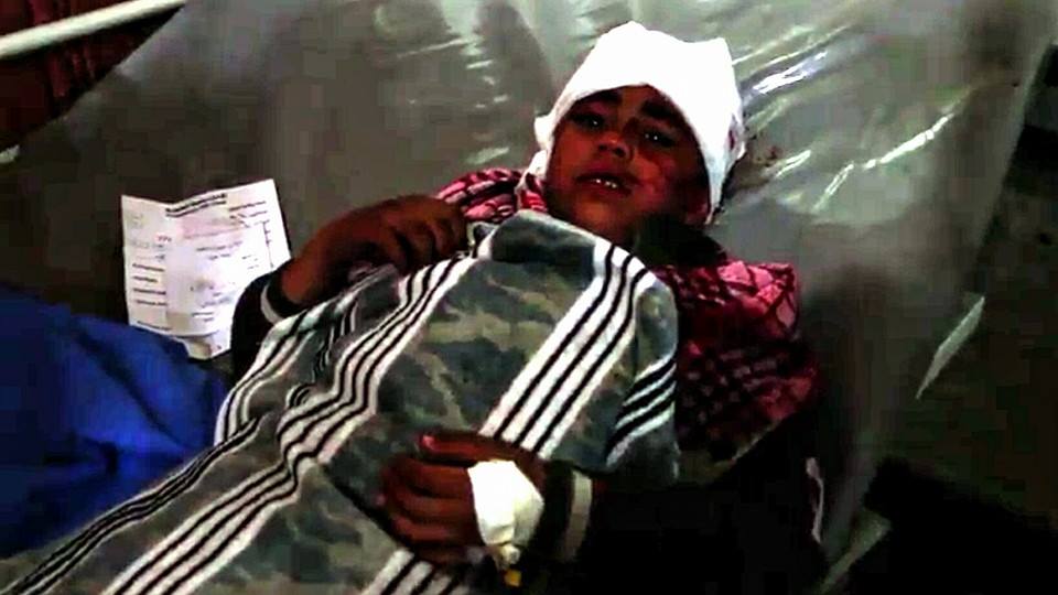 An image shows an injured child after the alleged coalition airstrike in Mosul on March 5th (Via NRN News‎)