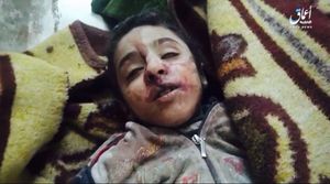 Victims of alleged strikes on Al-Batool hospital in West-Mosul (via Free journalist (Facebook)