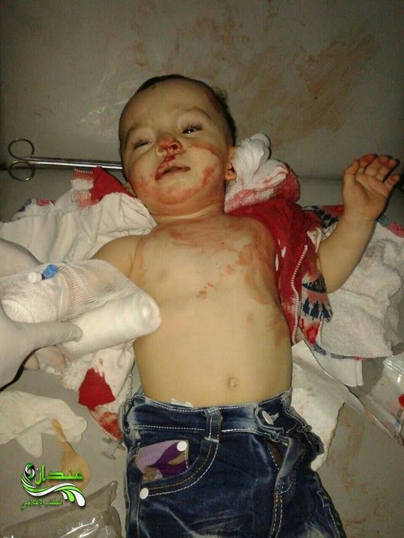 GRAPHIC: An injured child following alleged Russian airstrike on Baghdad Street, Hraytan, November 26th (via SN4HR) 