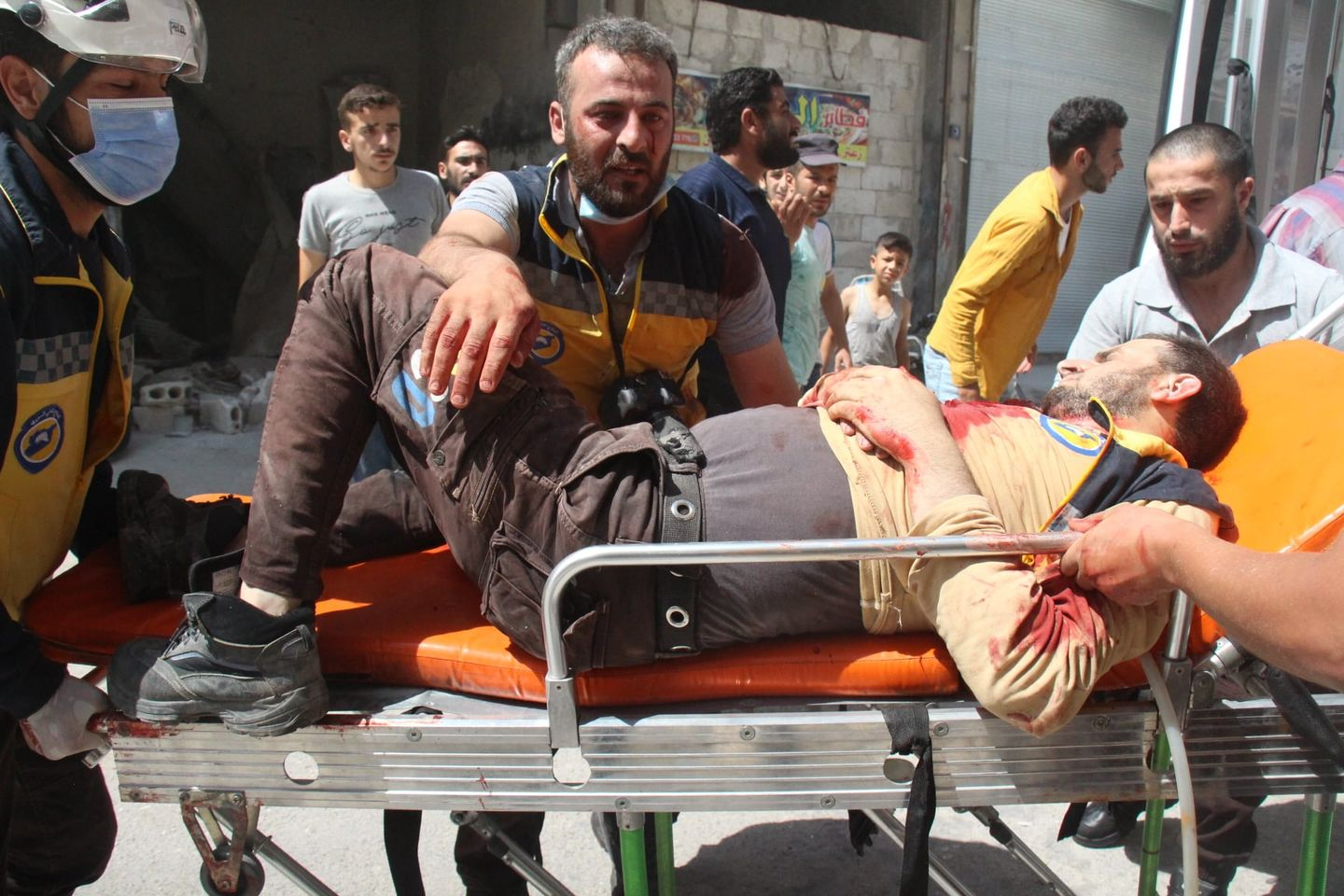 Injured Civil Defense member following a double strike on Sarja on July 17, 2021. (Image posted by Syrian Civil Defense)