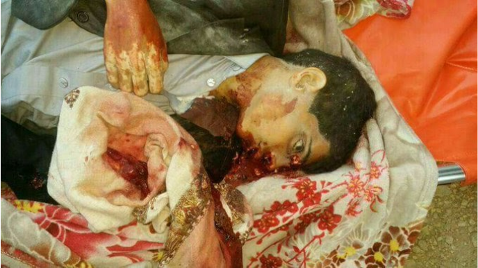 An alleged child casualty of the January 29th 2017 raid (@abu_japheth, January 29th 2017)