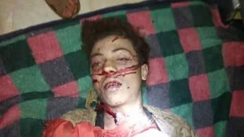 A victim of the alleged Russian raid on Bayneen, November 11th-12th (via SN4HR)