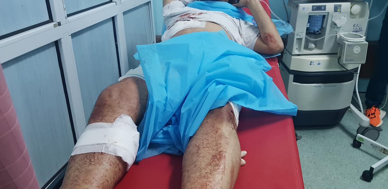 Victim being treated after shelling on Tripoli on February 4th, 2020 (via Tk Yahroug Kl shy)