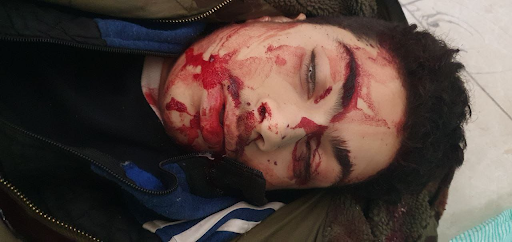 Graphic images of the dead and injured were uploaded online by @Almohrar1 (Image via Twitter)