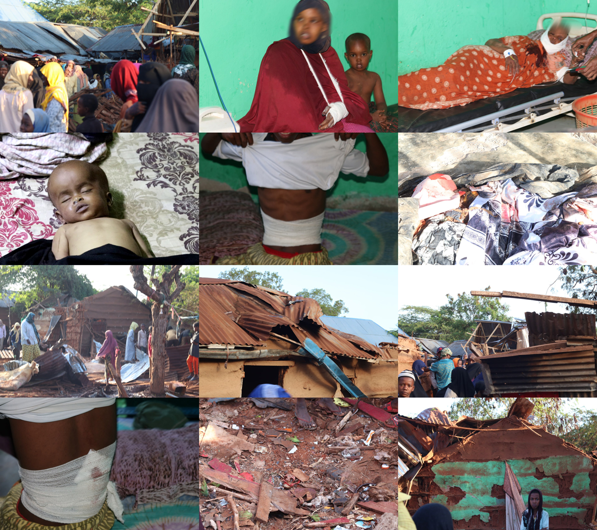 Damage and injuries caused by alleged Kenyan airstrikes on Jilib on August 15, 2023. (Image posted by Mepa News)