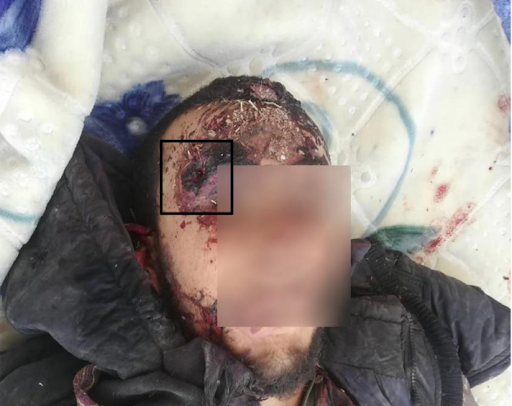Graphic image of victim Nawaf al-Khalaf, shot in the forehead by alleged Turkish forces on October 25, 2021. (Image posted by Syrians for Truth and Justice)