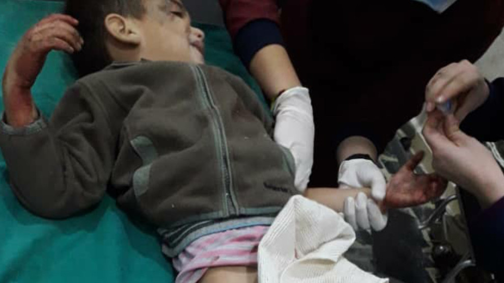 A child injured in the attack (via ANF)
