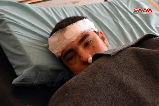 One of the children injured in alleged Israeli airstrikes or Syrian regime rockets in Kazo neighborhood in Hama on January 22nd, 2021. (via SANA).