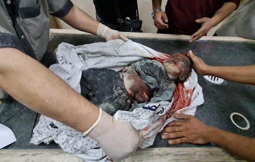 Very graphic image of a child allegedly killed in strikes on Al Jeniya neighborhood on May 13, 2021. (Image posted by Paltoday News)