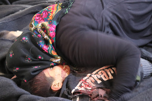 A child killed in an alleged Turkish attack on Tal Rifaat. Dec 2nd 2019 (via ANHA)