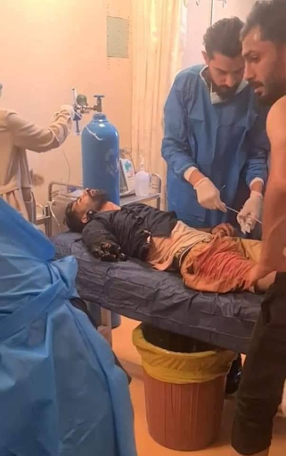 Very graphic image of one of the men injured in the alleged Turkish artillery shelling that hit a touristic site in Kurdistan Region’s Duhok province on July 17, 2022. (Image posted by Almaalomah)