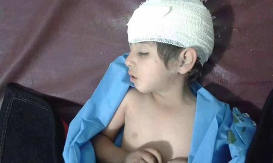 Child victim of reported Coalition or Iraq government airstrike on Fallujah, May 19th 2016 (via Fallujah Now)
