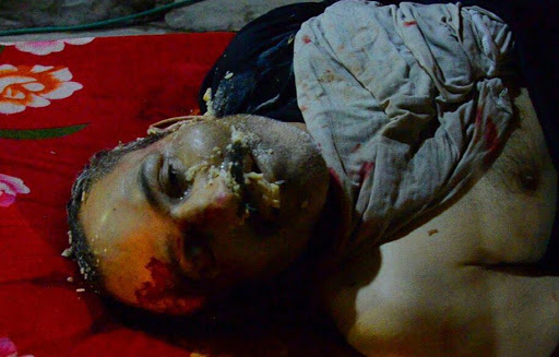 Photos of the alleged incident provided by an eyewitness, resident in Mosul that Airwars made contact with by phone on 20/04/2015. They were taken by his brother who lives in the neighbourhood that was bombed