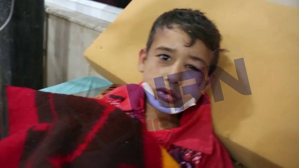 An image shows an injured child who survived from an alleged coalition strike at Tal Afar, May 5th 2016 (via NRN)