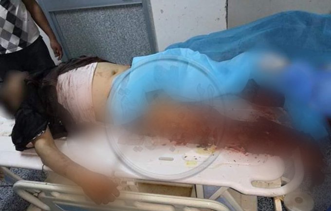 Victm of alleged GNA/Turkish strike on Qasr BIn Gashir on June 3rd, 2020 (via Libyan Review)