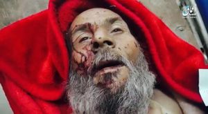 Victims of alleged strikes on Al-Batool hospital in West-Mosul (via Free journalist (Facebook)