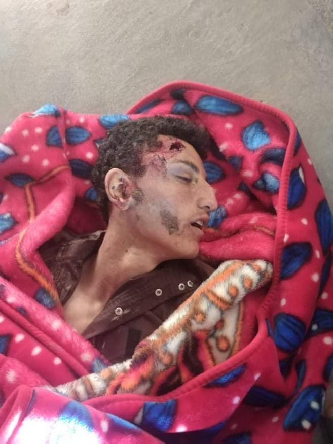 Graphic image of Ahmed Sherida Al-Ghadeer, who was killed in a raid in the town of Thiban on July 16, 2021. (Image posted by @YusufAd76532779)