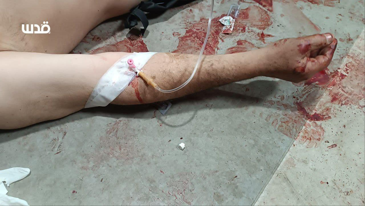 Source: M. Al-Atrash is injured