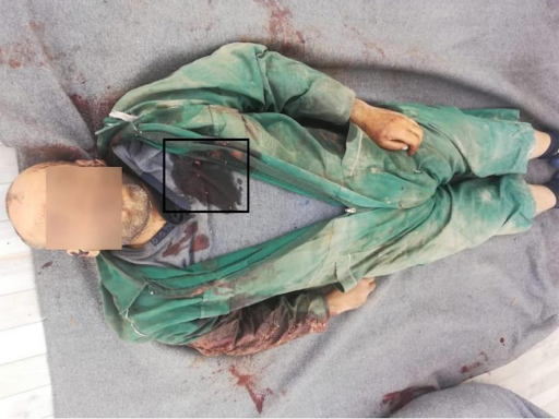 Graphic image of victim Sami al-Khuzami, who was targeted just in the heart by alleged Turkish forces on October 25, 2021. (Image posted by Syrians for Truth and Justice)
