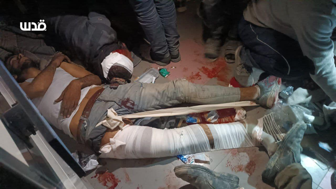 Source: M. Al-Atrash is injured