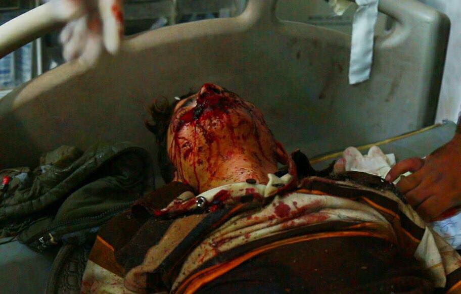 Photos of the alleged incident provided by an eyewitness, resident in Mosul that Airwars made contact with by phone on 20/04/2015. They were taken by his brother who lives in the neighbourhood that was bombed