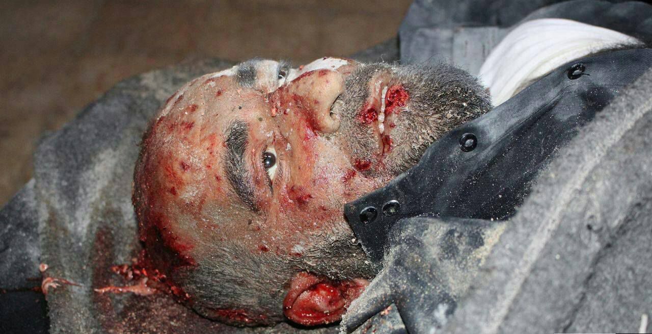 EXTREMELY GRAPHIC: Body of a man killed in alleged Russian airstrike on Tabaqua, November 28th (via Raqqa is Being Silently Slaughtered)