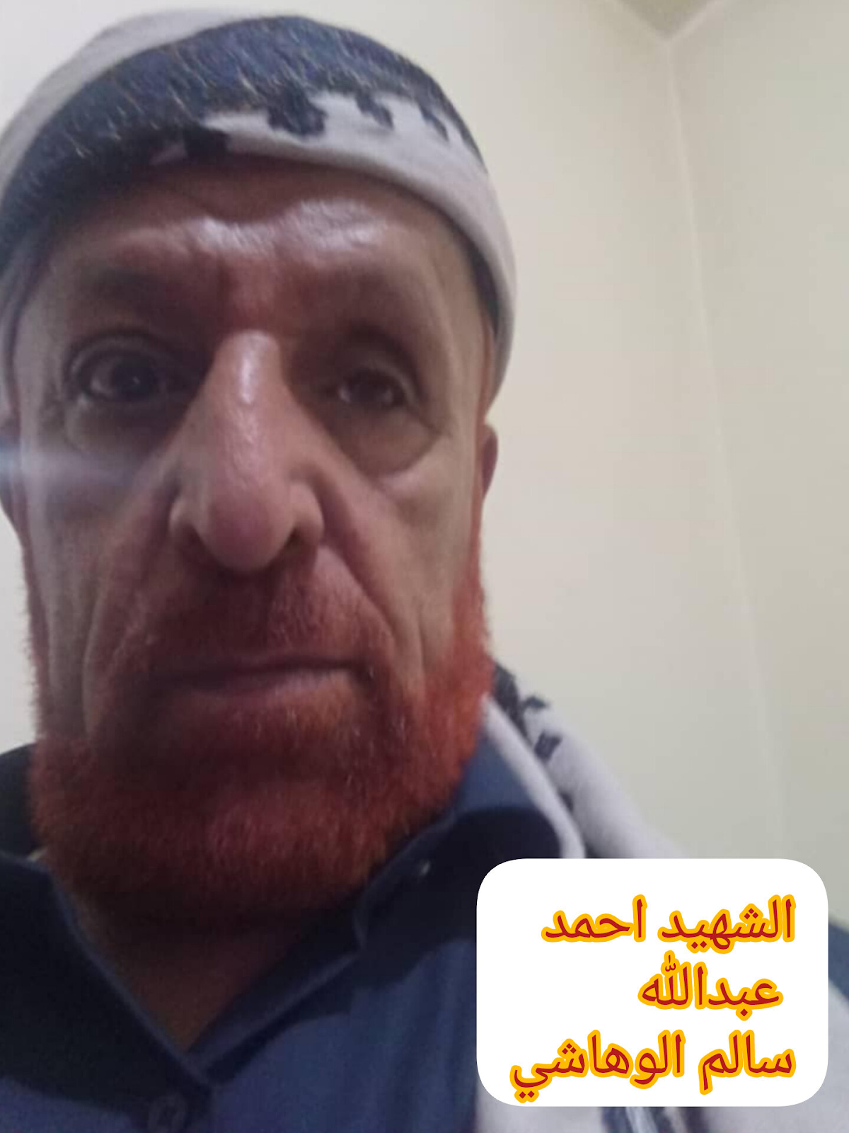 Source: Mohammed Abdullah Sharif