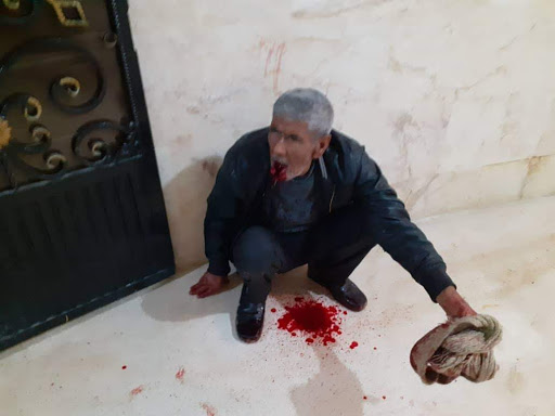 Most of those killed and injured in the alleged Turkish strike on Tal Rifaat, Dec 2nd 2019, are children (via SOHR).
