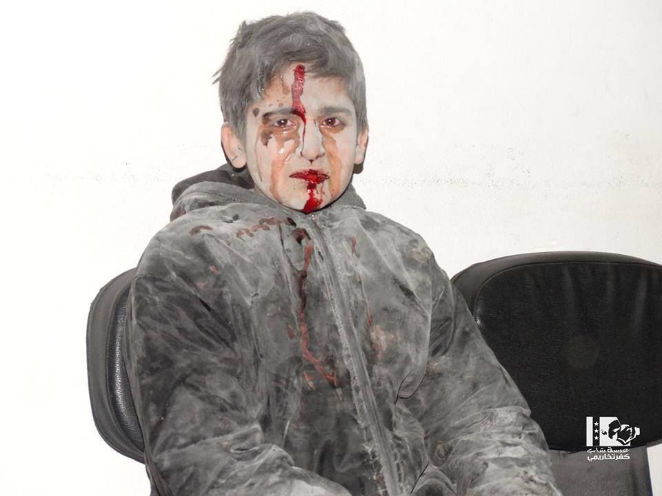 An injured child following an alleged Russian strike on Kafr Takharim, Jan 28th (via SNN)