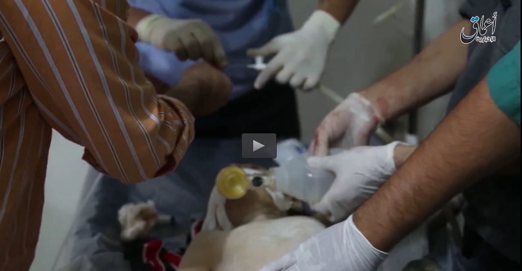Daesh propaganda of a child injured in an airstrike on Al Bab October 25th 2015