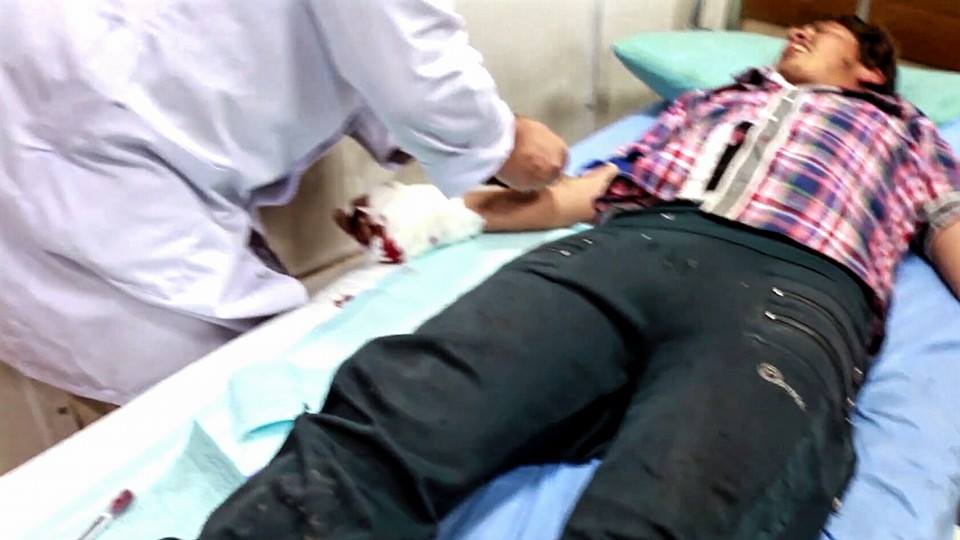 An image shows an injured child followed an alleged Coalition strike at Wadi Hajar, March 27th (via NRN News)